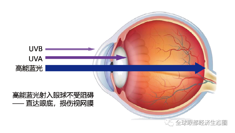 你的防藍(lán)光眼鏡戴對了嗎